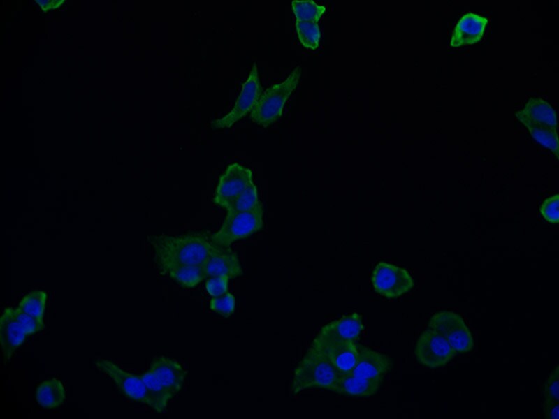 Aconitase 1 Antibody (22C10)