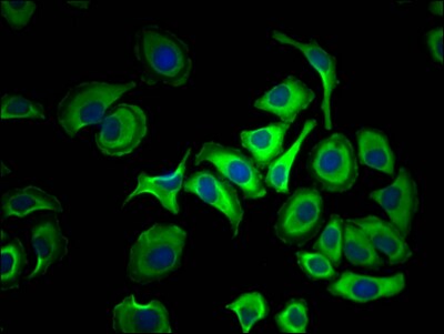 ATP Citrate Lyase Antibody (3A5)
