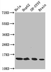Histone H3.1 [ac Lys14] Antibody (3H3)