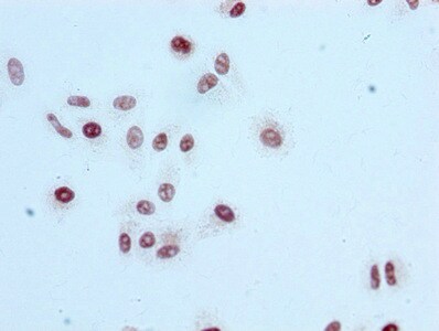 Histone H3.1 [ac Lys56] Antibody (3H2)