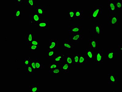Histone H3.1 [ac Lys56] Antibody (3H2)