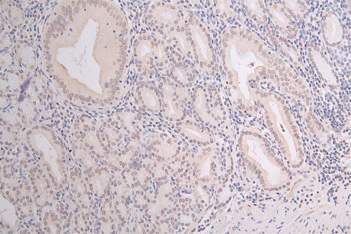 HIST1H3A [ac Lys18] Antibody (30A7)