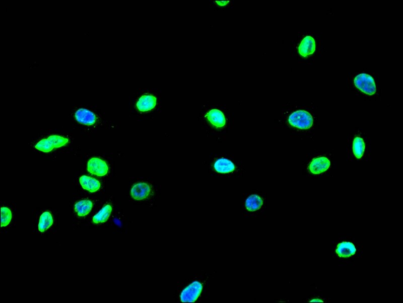 HIST1H3A [ac Lys18] Antibody (30A7)