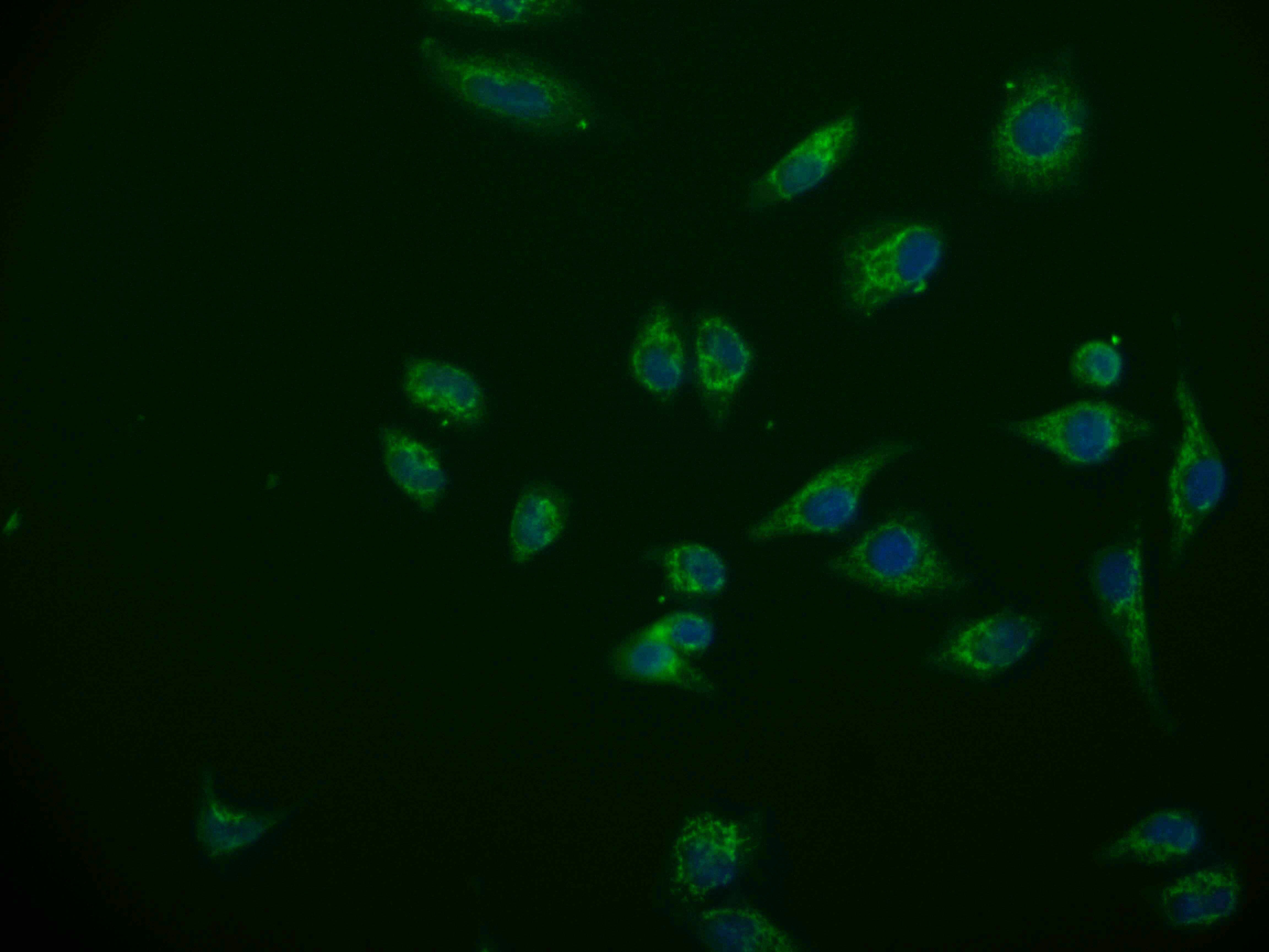 ACAA2 Antibody (12F4)