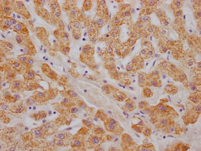 ABAT Antibody (5B6)