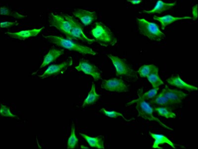 GSK-3 beta Antibody (9G11)