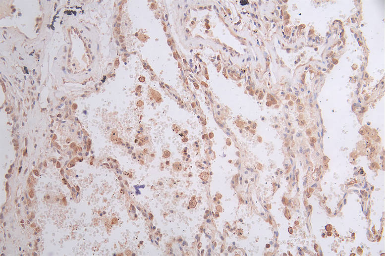Glucose 6 phosphate isomerase Antibody (12A4)