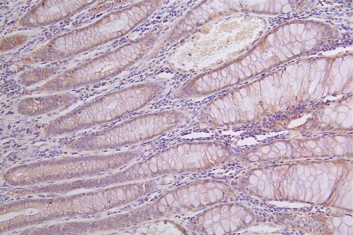alpha-Galactosidase A/GLA Antibody (30H11)