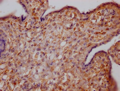 Growth Hormone R Antibody (10C11)