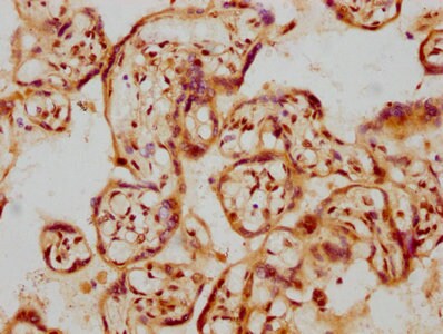 GDNF Antibody (11D2)