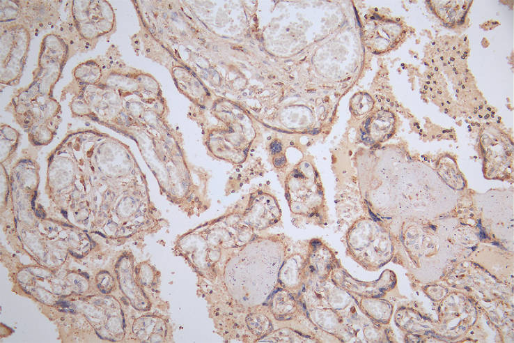 LYAG/GAA Antibody (5E5)