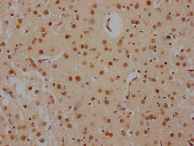FUBP1 Antibody (7C3)