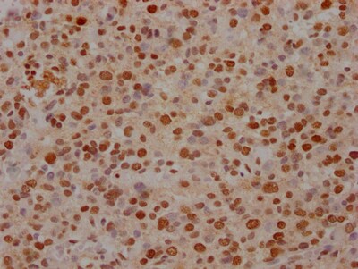 FUBP1 Antibody (7C3)
