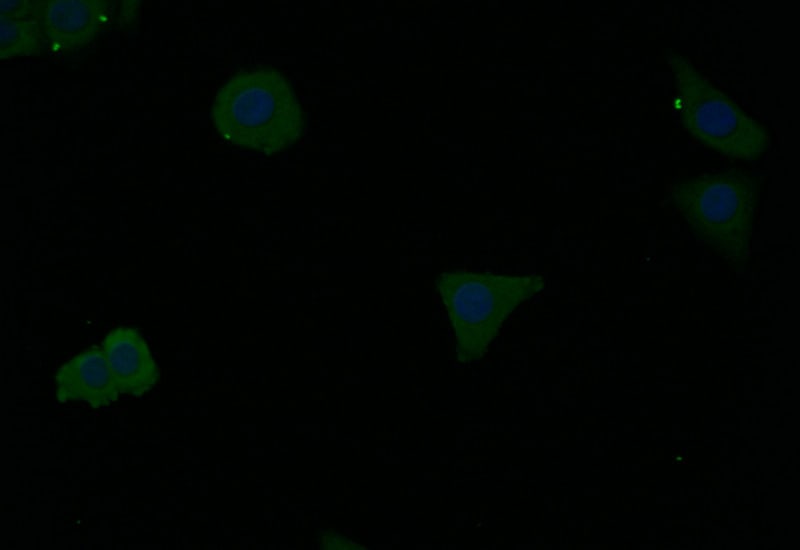 Ferritin Antibody (39G3)