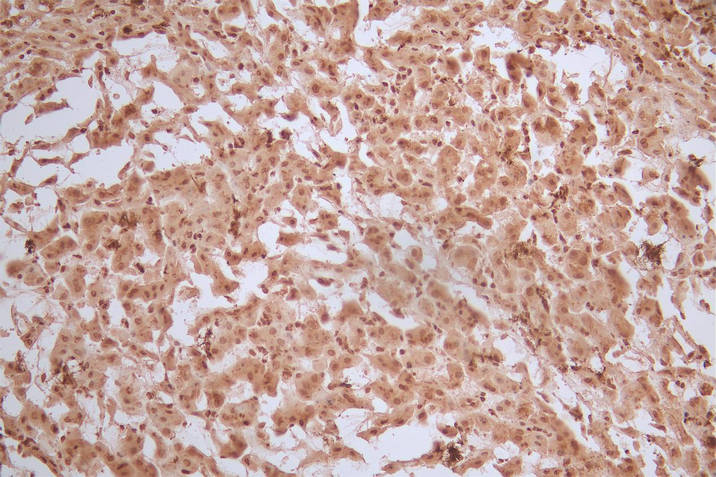 Ferritin Antibody (12H1)