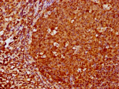 FOXO3 Antibody (1E2)