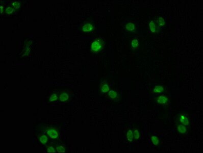 FOXO3 Antibody (1E2)