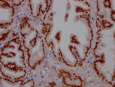 HNF-3 alpha/FoxA1 Antibody (3B2)