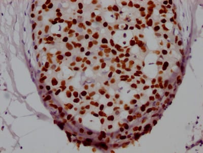 HNF-3 alpha/FoxA1 Antibody (3B2)