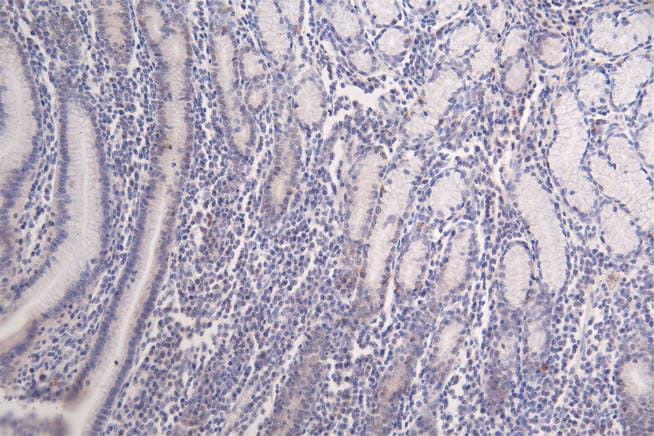 HIST1H3A [Formyl Lys122] Antibody (32C1)