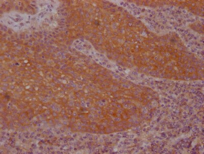 FNTB Antibody (5H4)