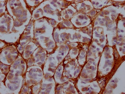 Fibronectin Antibody (1E1)