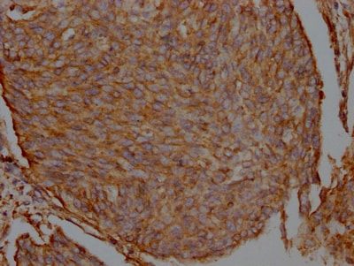 Filamin A Antibody (1B2)