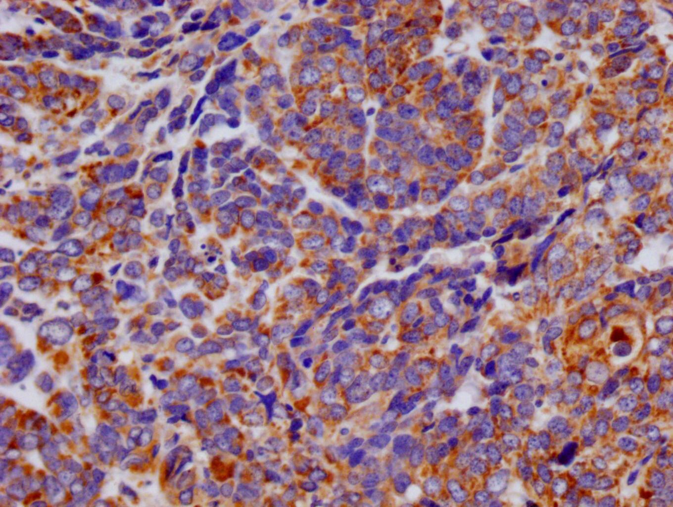 TTC11 Antibody (27B4)