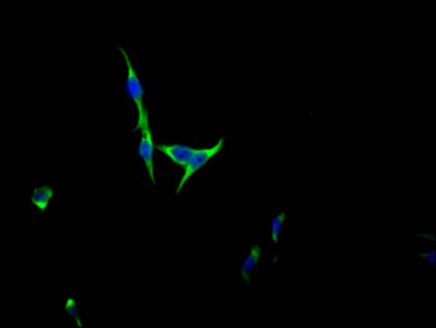 FGFR3 Antibody (5B6)