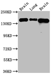 FGFR2 Antibody (2E9)