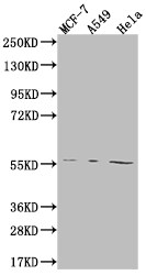 FADS1 Antibody (7A10)