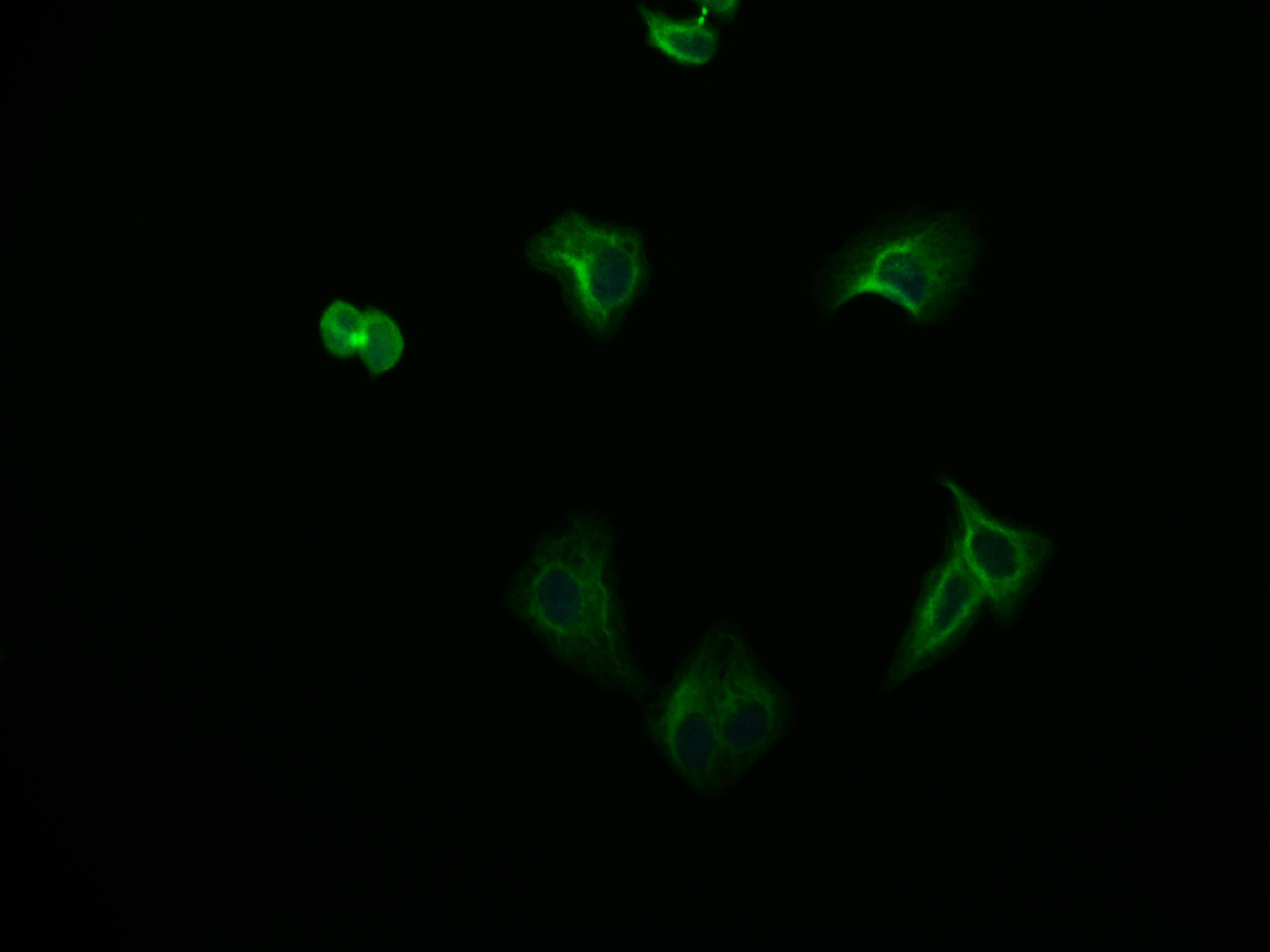 FADS1 Antibody (7A10)