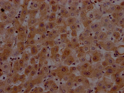 Prothrombin Antibody (9A1)