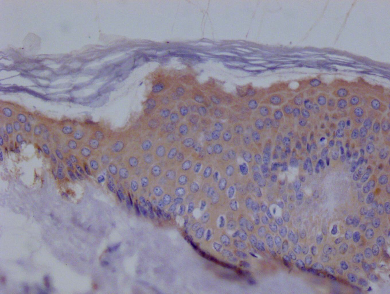Ezrin Antibody (7F11)