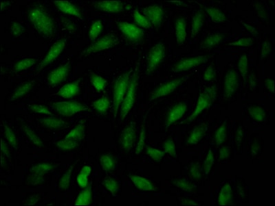 HIF-2 alpha/EPAS1 Antibody (6A9)