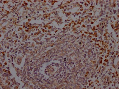 Neutrophil Elastase/ELA2 Antibody (2H12)