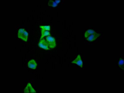 eIF5A Antibody (5E1)