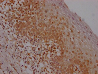 E2F-1 Antibody (1D12)