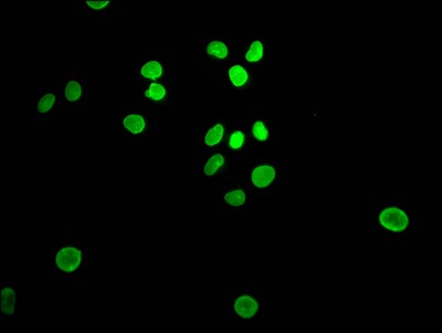 E2F-1 Antibody (1D12)
