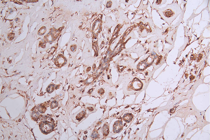 CRMP2 Antibody (20D8)