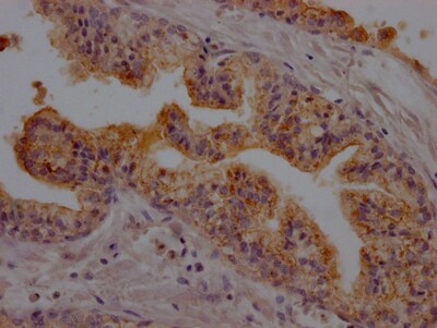DPPIV/CD26 Antibody (6G7)