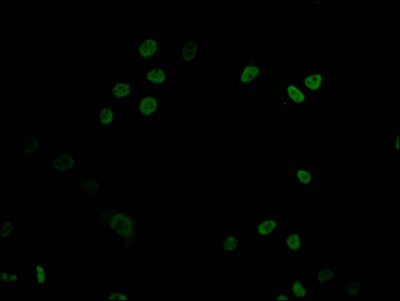 DNMT1 Antibody (1A9)