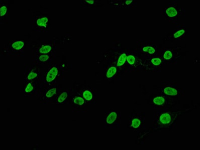 Histone H3.1 [Dimethyl Lys4] Antibody (6F6)