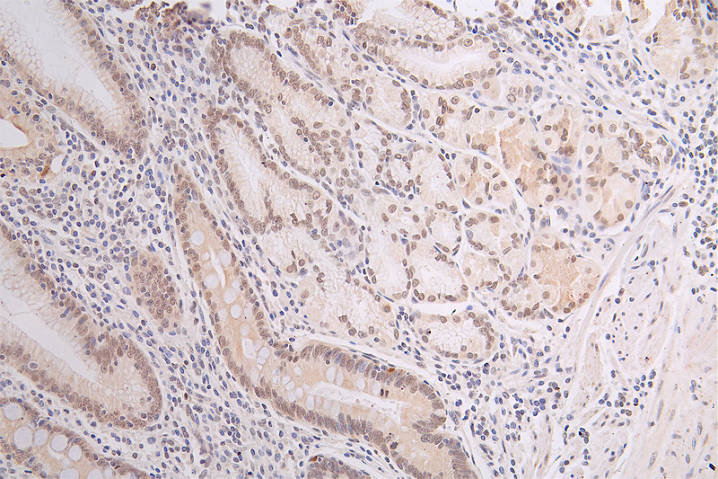 DEK Antibody (20D2)