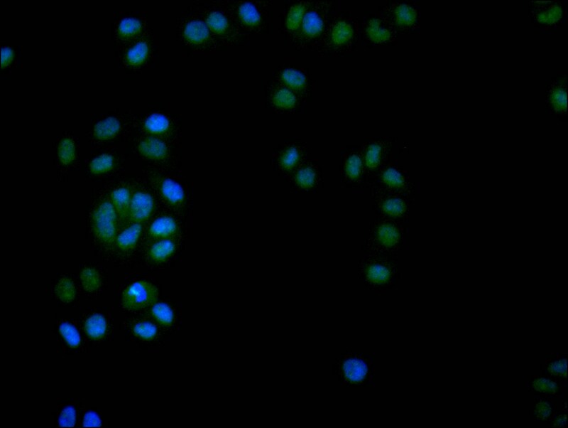 DEK Antibody (20D2)