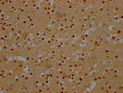 DDX6 Antibody (6D8)