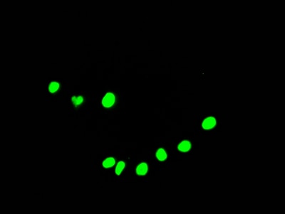 DDX5 Antibody (2C3)