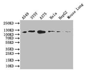 DDR2 Antibody (9A9)