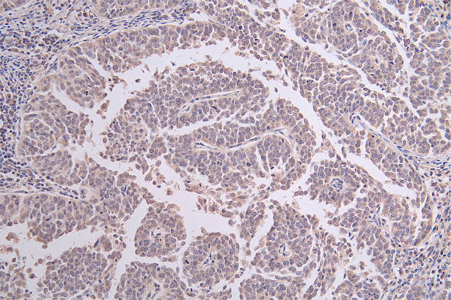 XPE/DDB2 Antibody (24E5)