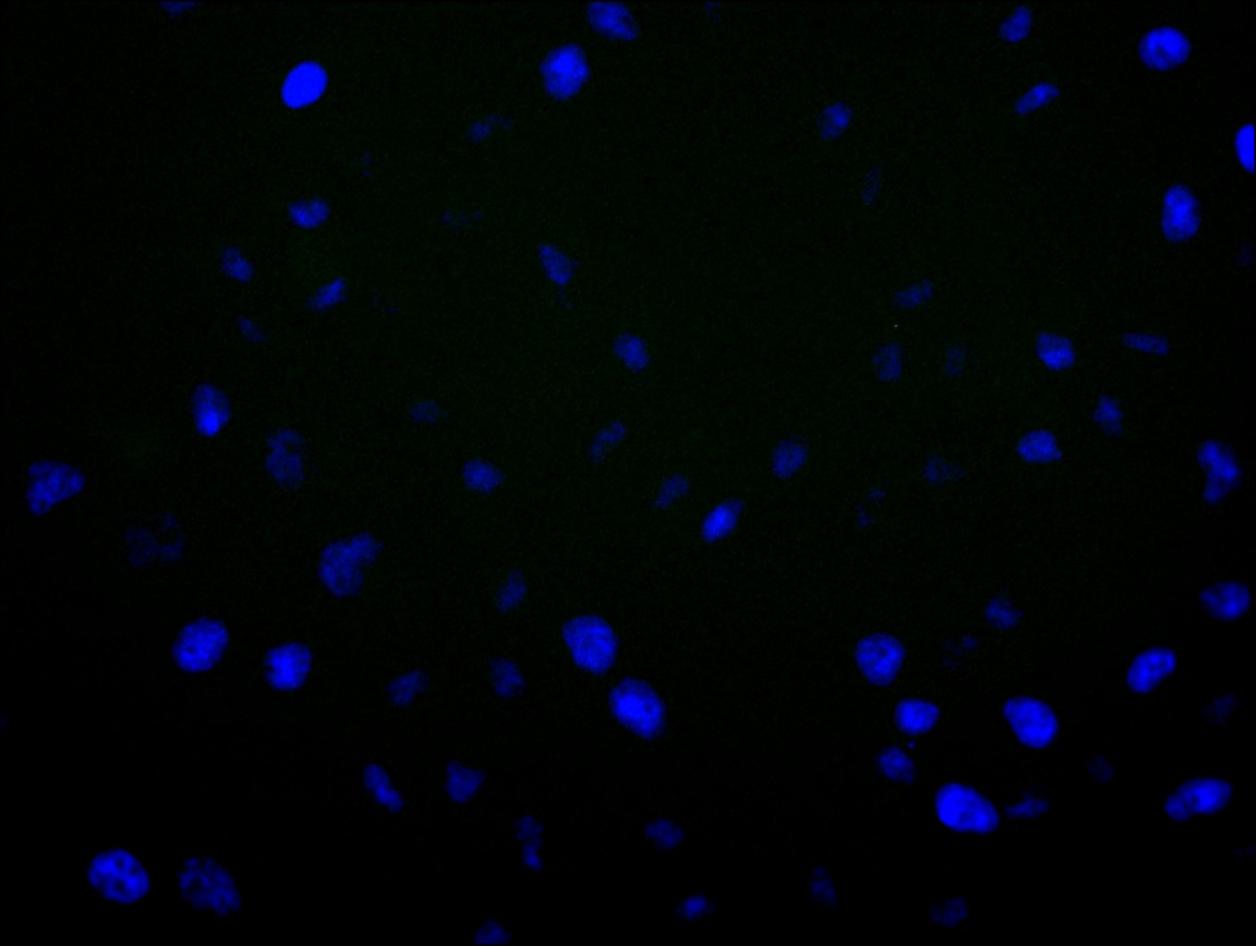 Aromatase Antibody (1H1)